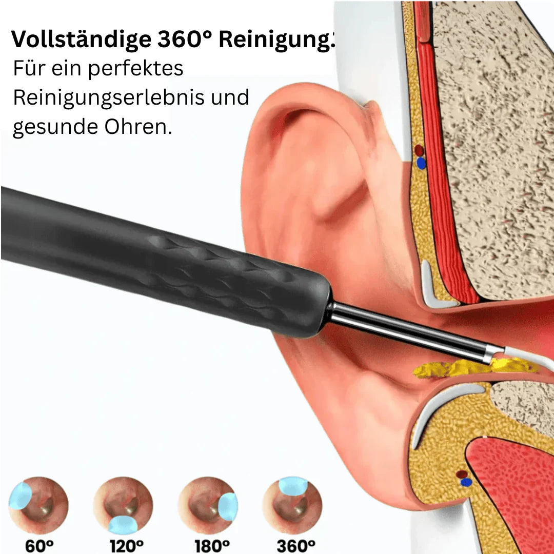 💥Intelligenter wasserdichter visueller Ohrenschmalzentferner