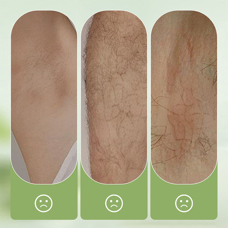 Gentle and non-irritating hair removal cream set (hair removal cream + razor) | Limited-time offer 🎁|Limited-time offer🎁