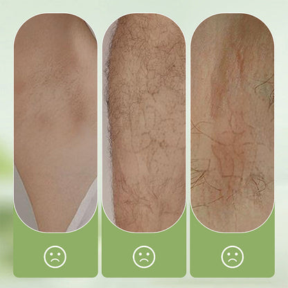 Gentle and non-irritating hair removal cream set (hair removal cream + razor) | Limited-time offer 🎁|Limited-time offer🎁