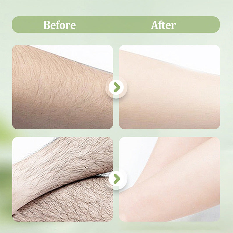 Gentle and non-irritating hair removal cream set (hair removal cream + razor) | Limited-time offer 🎁|Limited-time offer🎁