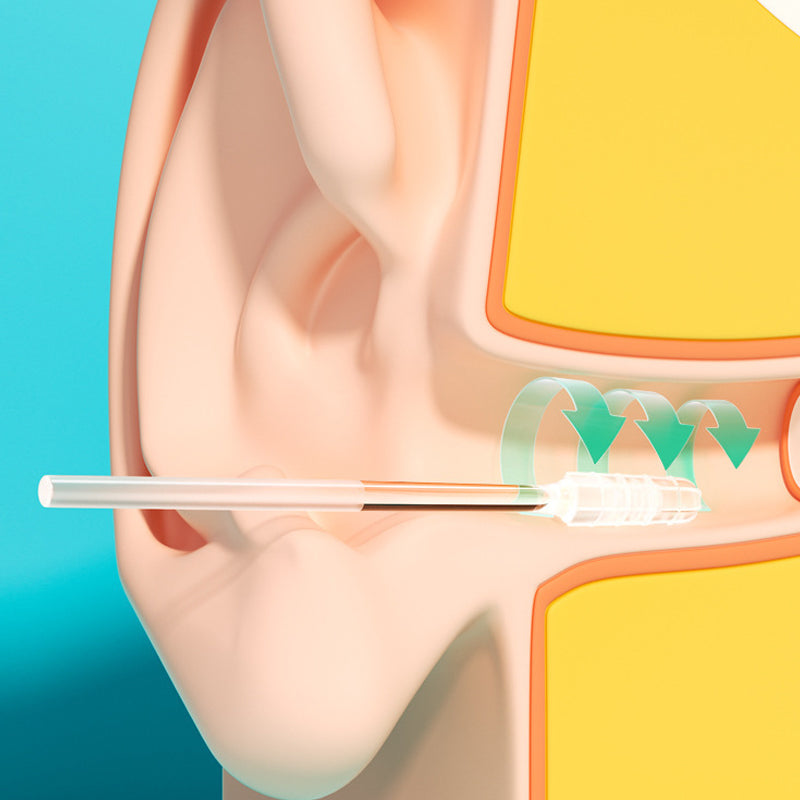 Adhesive Ear Wax Removal Tool Kit